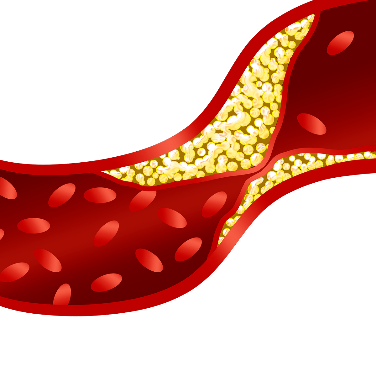 cholesterol