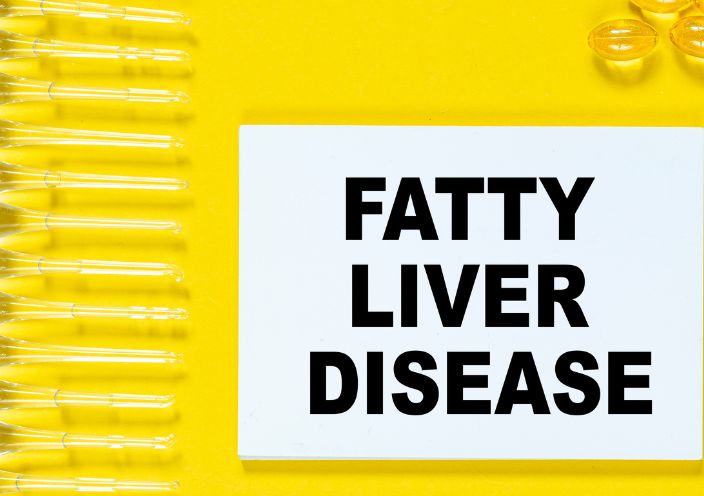 Fatty liver disease written on a note