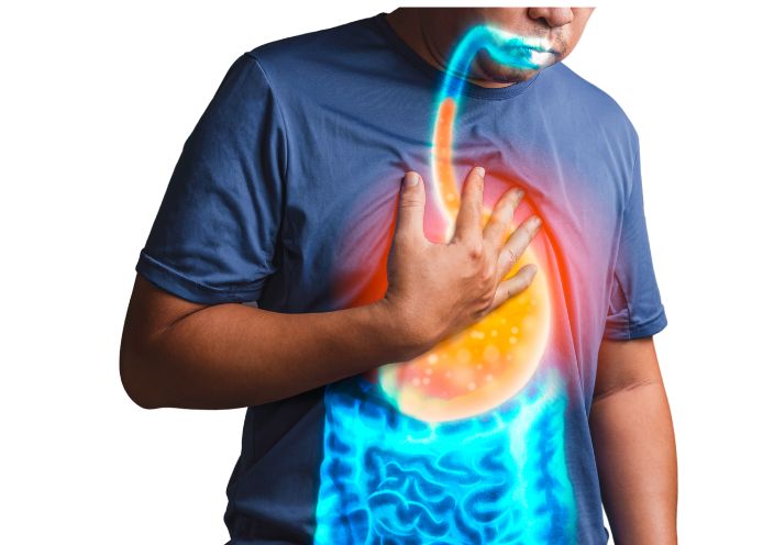 Illustration of acid reflux and the digestive system
